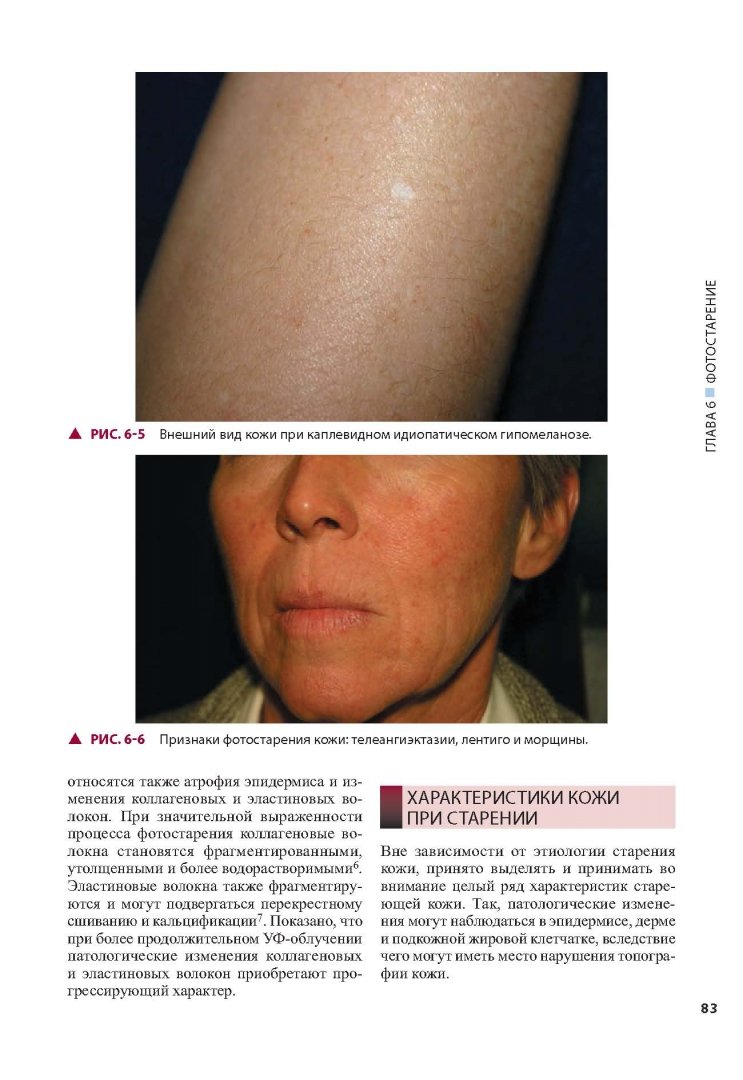 Иллюстрация 14 из 30 для Косметическая дерматология. Принципы и практика - Лесли Бауманн | Лабиринт - книги. Источник: Лабиринт