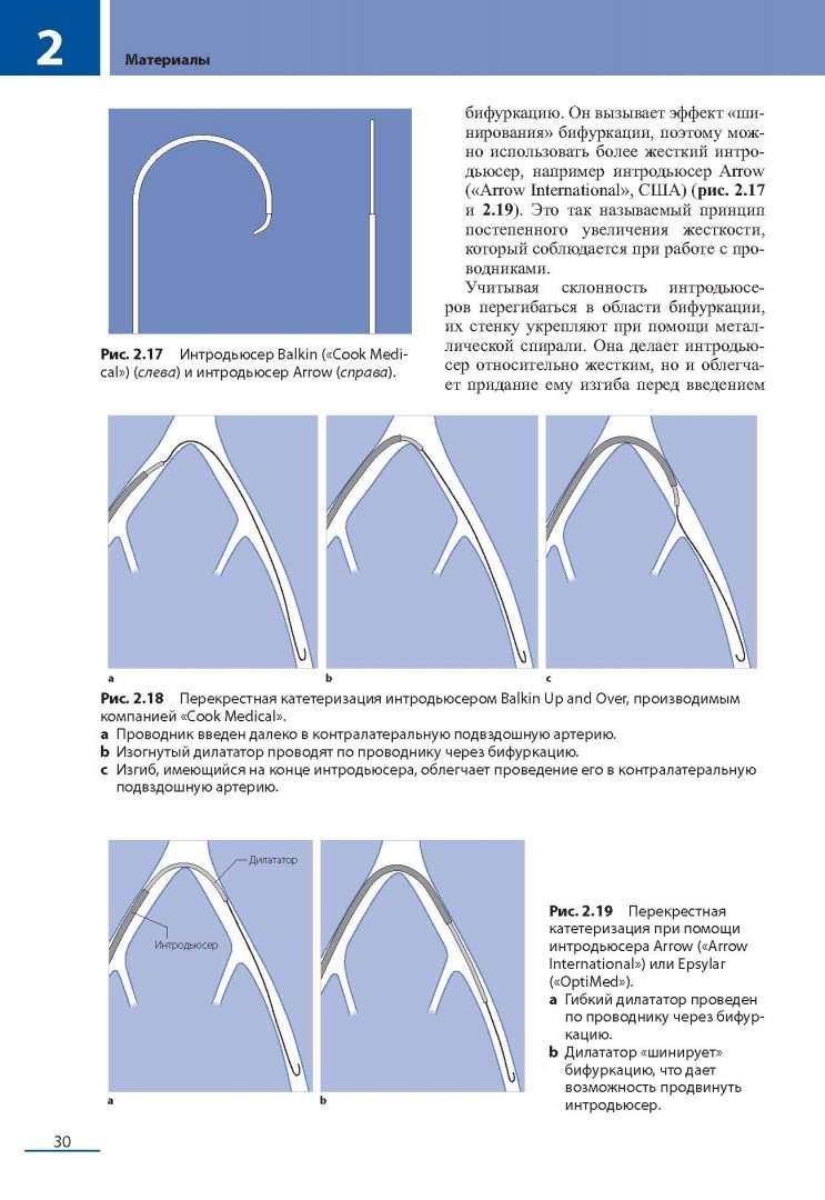 Иллюстрация 19 из 27 для Эндоваскулярные вмешательства на периферических сосудах - Юрген Шредер | Лабиринт - книги. Источник: Лабиринт