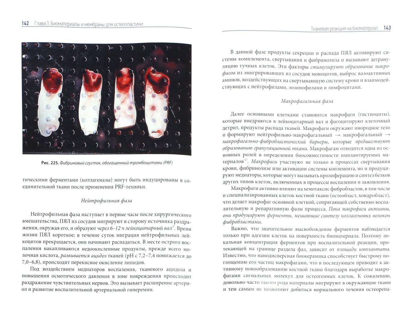 Иллюстрация 1 из 4 для Десневая и костная пластика в дентальной имплантологии - Бениашвили, Кулаков, Гурин | Лабиринт - книги. Источник: Лабиринт