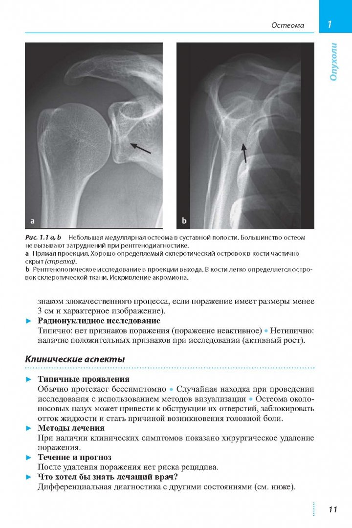 Иллюстрация 3 из 29 для Лучевая диагностика. Костно-мышечная система - Райзер, Баур-Мельник, Гласер | Лабиринт - книги. Источник: Лабиринт