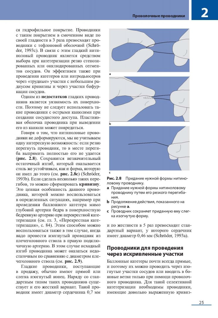 Иллюстрация 14 из 27 для Эндоваскулярные вмешательства на периферических сосудах - Юрген Шредер | Лабиринт - книги. Источник: Лабиринт