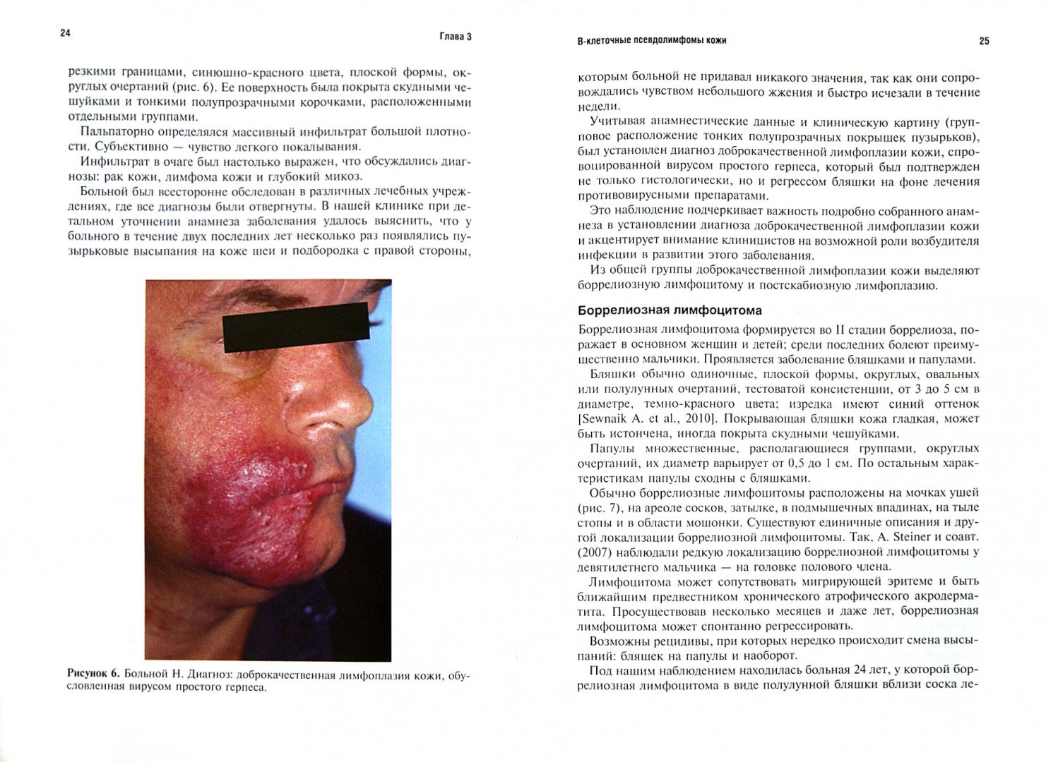 Иллюстрация 1 из 7 для Псевдолимфомы кожи - Олисова, Потекаев | Лабиринт - книги. Источник: Лабиринт