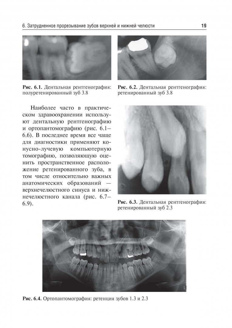 Иллюстрация 1 из 5 для Болезни прорезывания зубов. Учебное пособие ВУЗ - Эрнест Базикян | Лабиринт - книги. Источник: Лабиринт