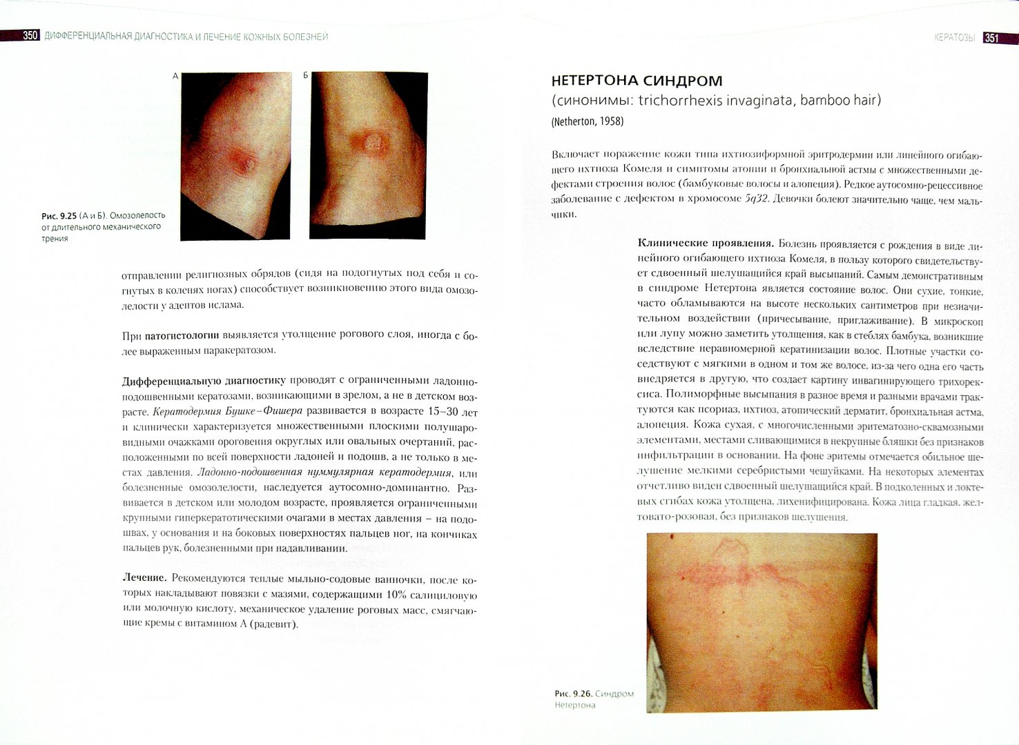 Иллюстрация 1 из 11 для Дифференциальная диагностика и лечение кожных болезней - Потекаев, Акимов | Лабиринт - книги. Источник: Лабиринт