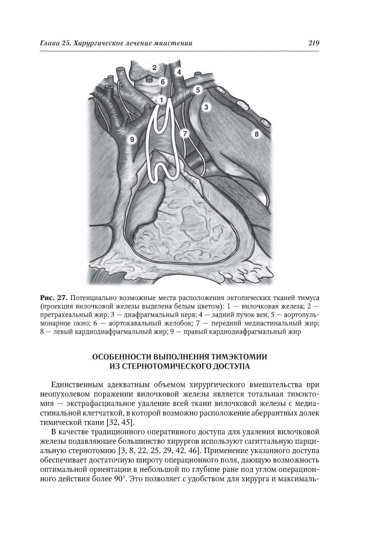 Иллюстрация 5 из 20 для Миастения и миастенические синдромы. Руководство - Александр Санадзе | Лабиринт - книги. Источник: Лабиринт