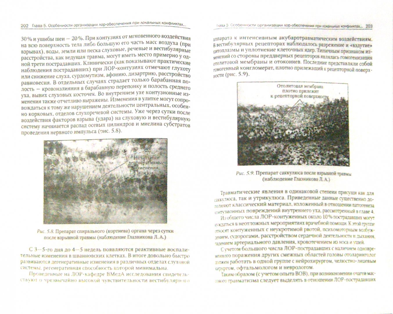 Иллюстрация 1 из 5 для Военная оториноларингология - Горохов, Шелепов, Янов | Лабиринт - книги. Источник: Лабиринт