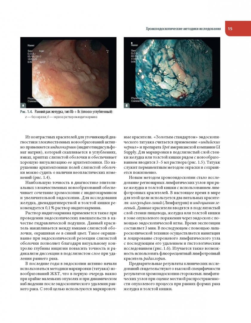 Иллюстрация 9 из 12 для Атлас видеоэндоскопических внутрипросветных операций в клинической онкологии - Соколов, Белоус, Булгакова | Лабиринт - книги. Источник: Лабиринт
