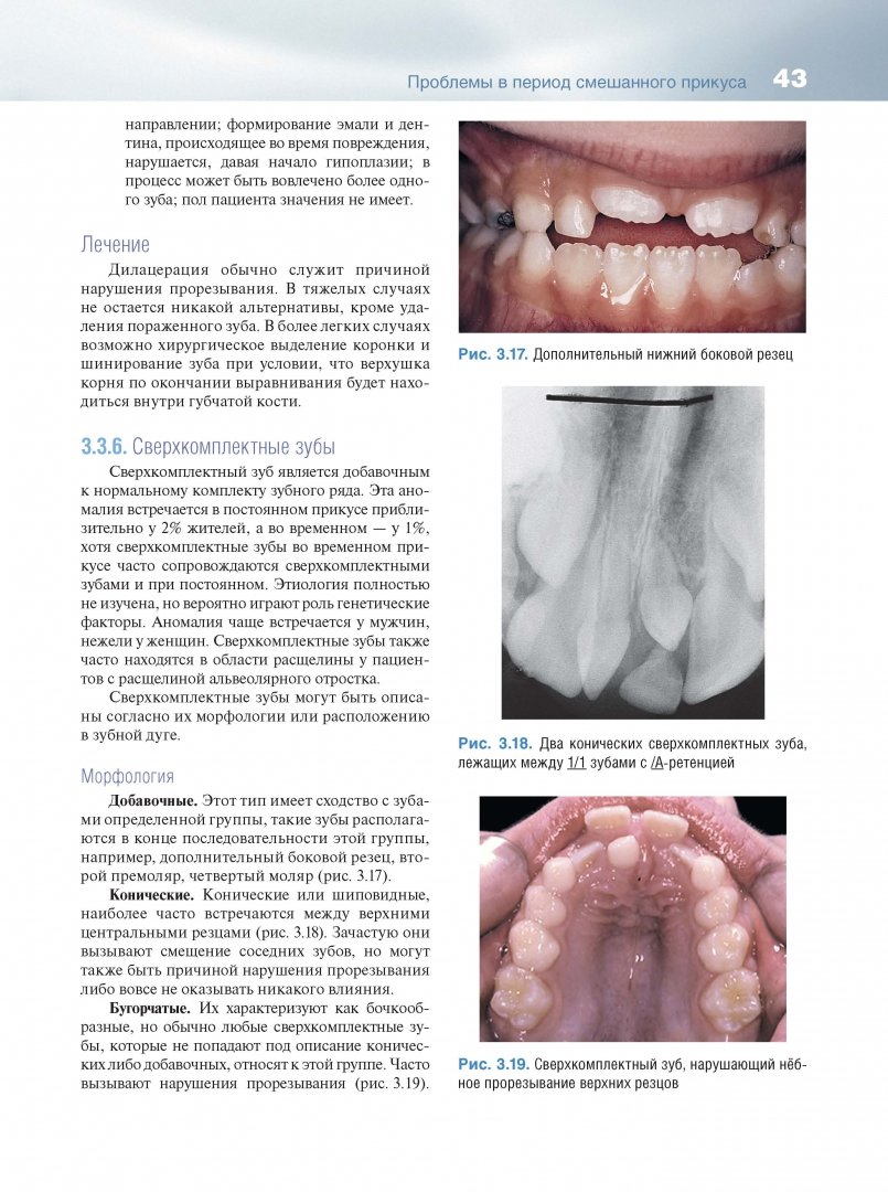 Иллюстрация 13 из 19 для Основы ортодонтии - Лаура Митчелл | Лабиринт - книги. Источник: Лабиринт