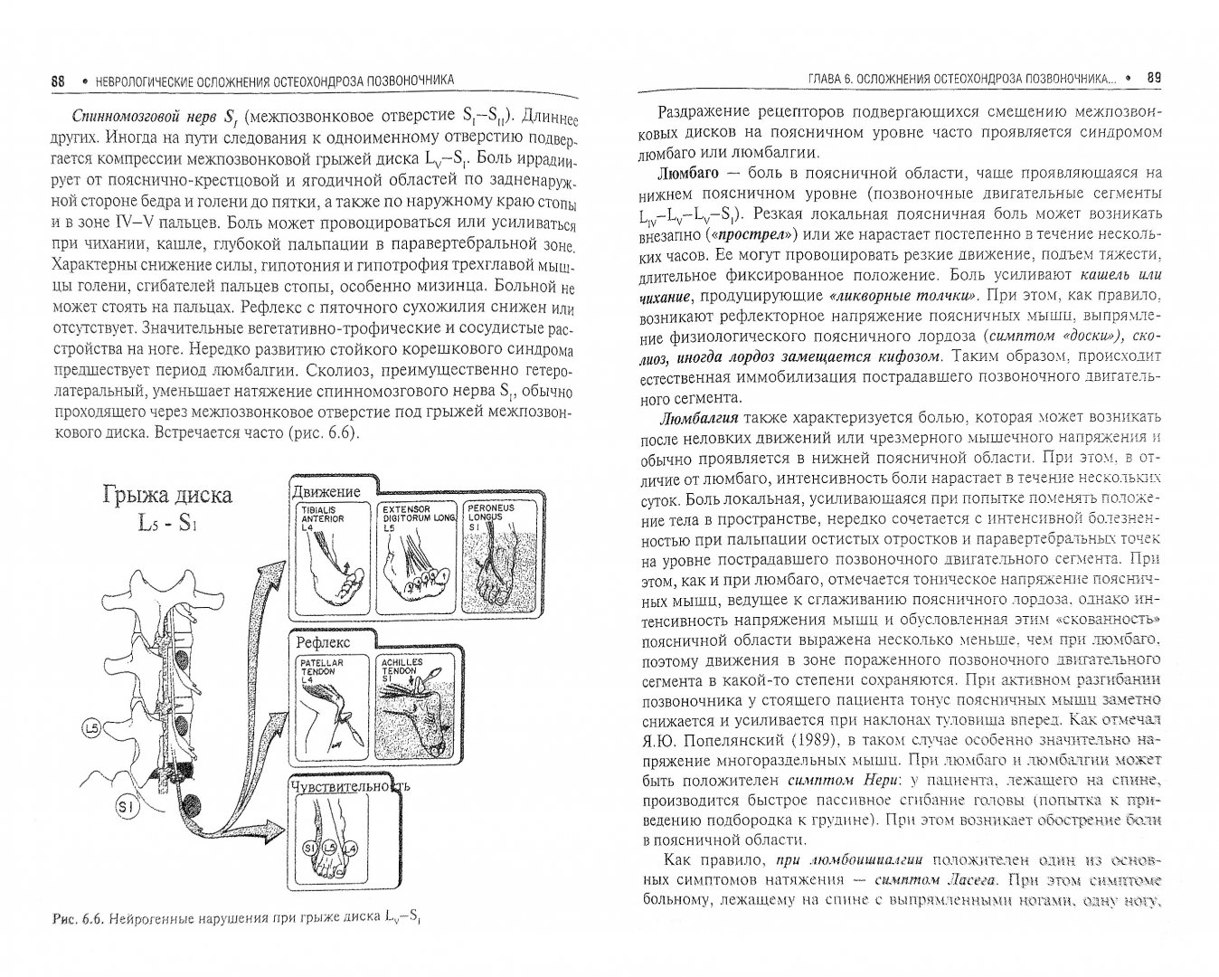 Иллюстрация 1 из 9 для Неврологические осложнения остеохондроза позвоночника - Никифоров, Авакян, Мендель | Лабиринт - книги. Источник: Лабиринт