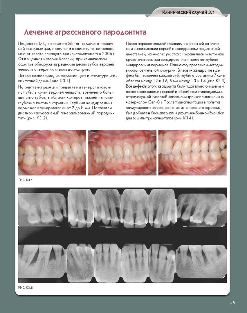 Иллюстрация 2 из 15 для Регенеративные технологии в стоматологии. Научно-практическое руководство - Барон, Нанмарк | Лабиринт - книги. Источник: Лабиринт