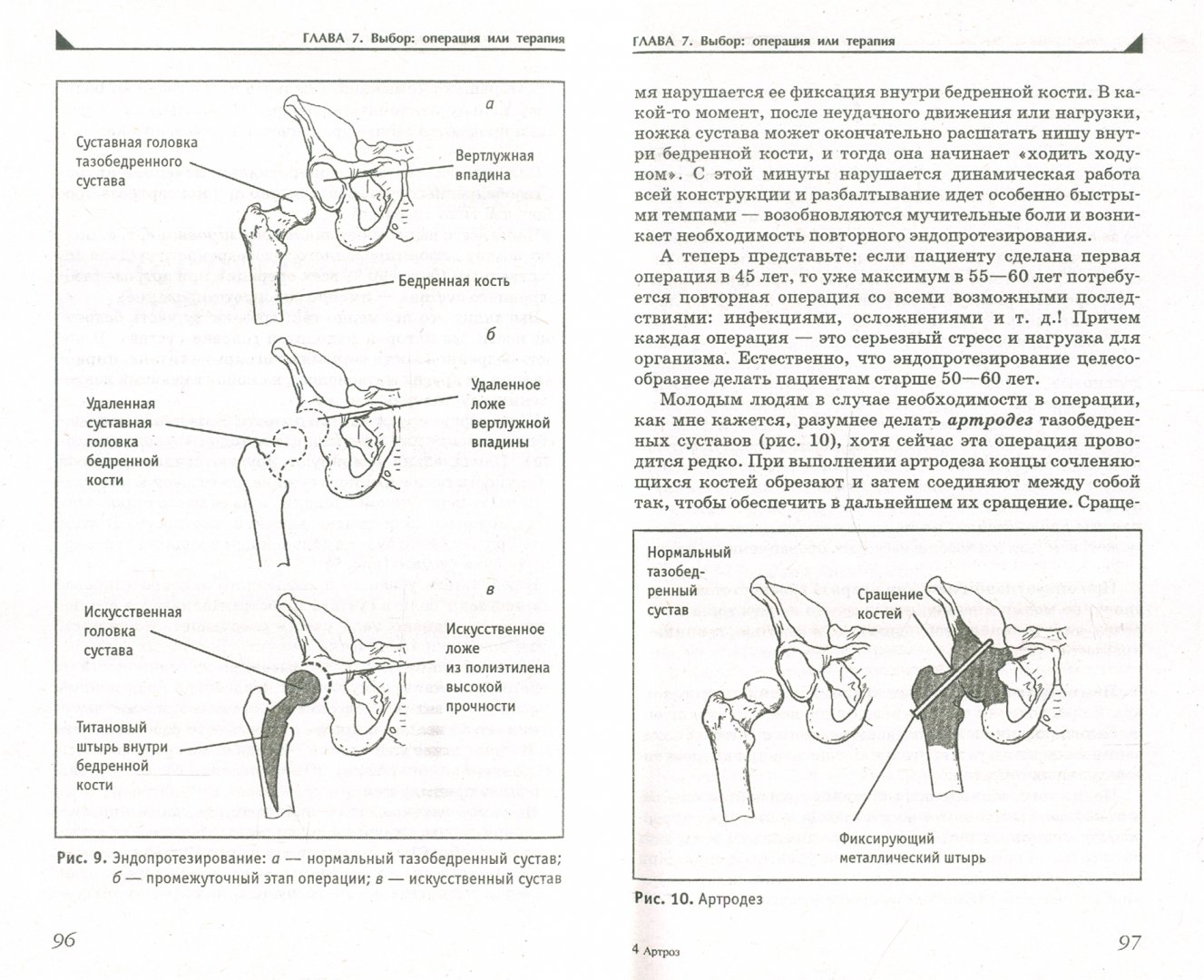 Иллюстрация 1 из 15 для Артроз. Избавляемся от болей в суставах - Павел Евдокименко | Лабиринт - книги. Источник: Лабиринт