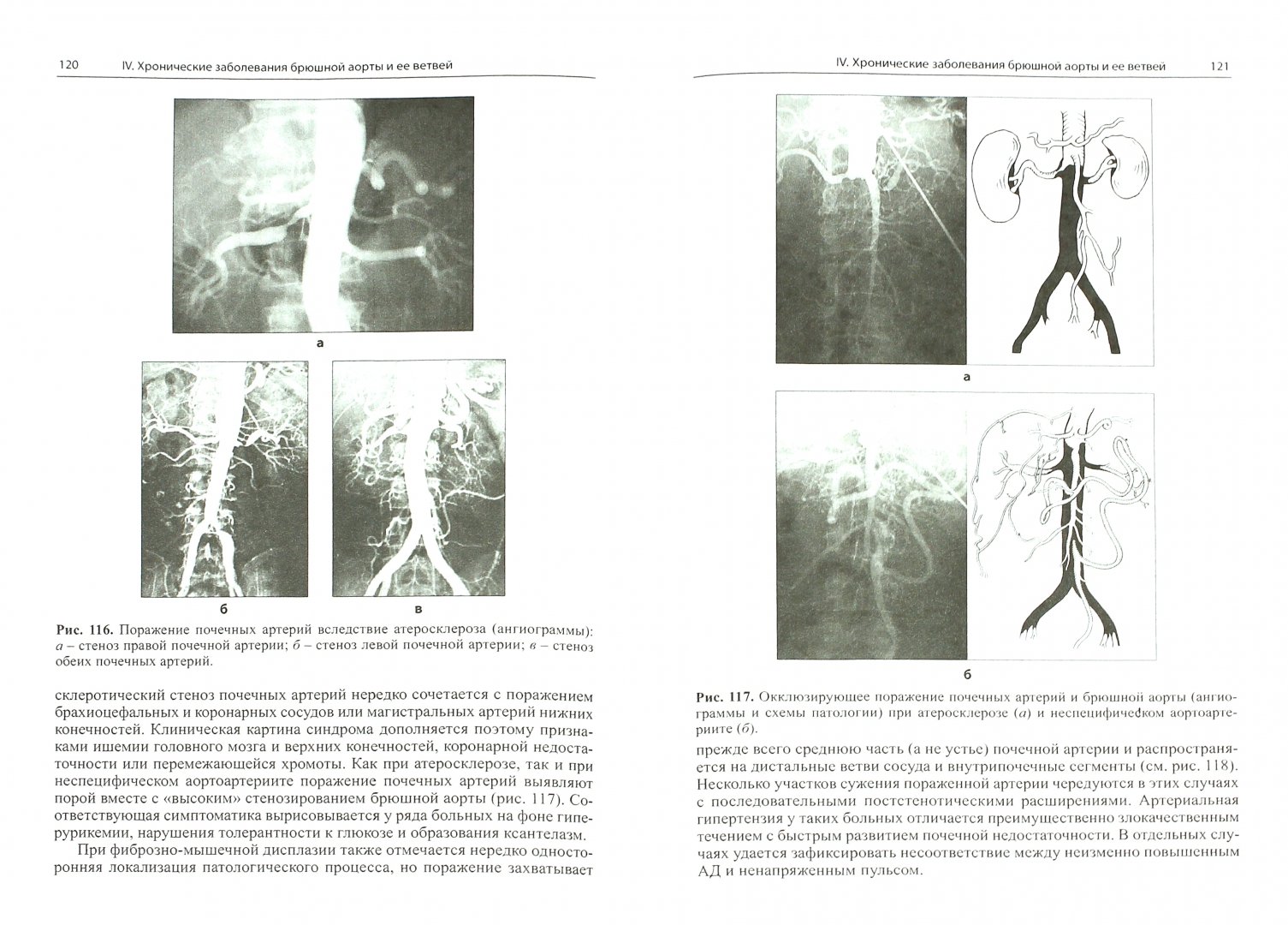 Иллюстрация 1 из 6 для Болезни артерий и вен - Евдокимов, Тополянский | Лабиринт - книги. Источник: Лабиринт