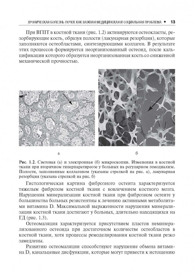 Иллюстрация 4 из 8 для Нарушения минерального и костного обмена при хронической болезни почек - Милованов, Милованова | Лабиринт - книги. Источник: Лабиринт